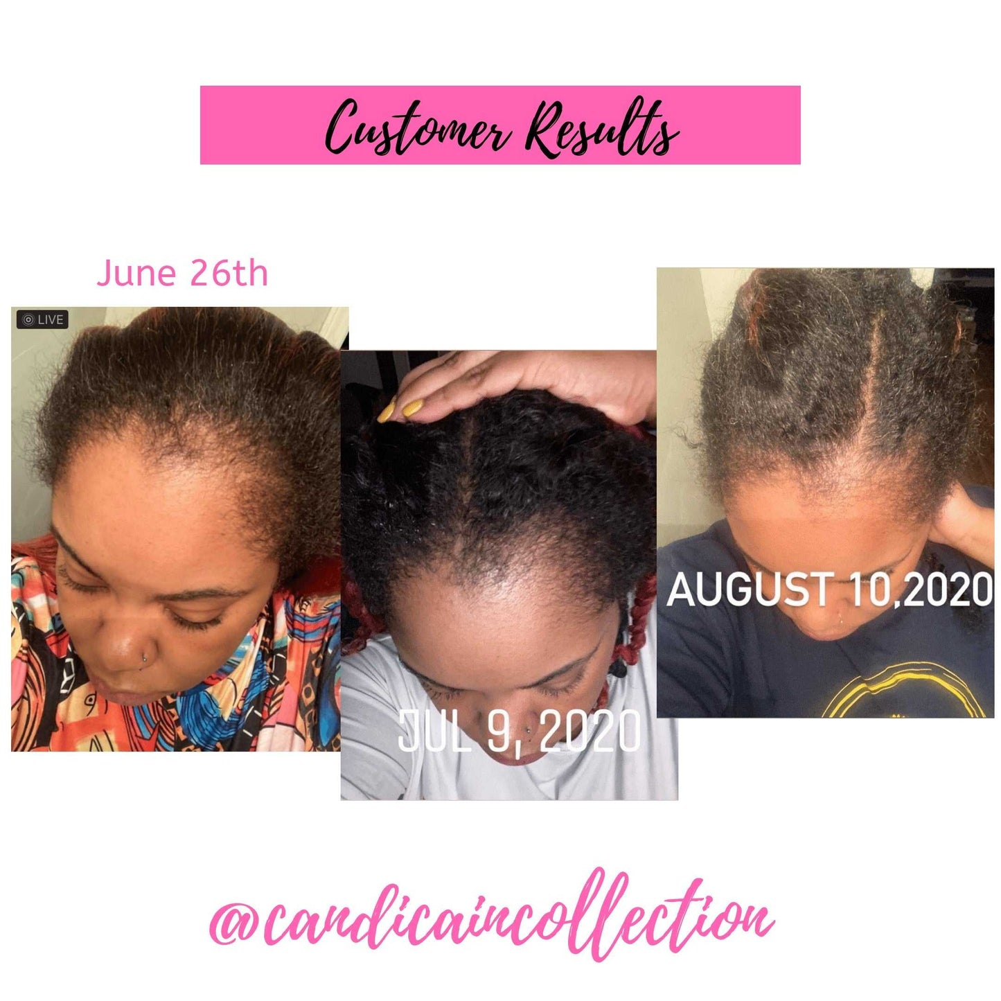 Queen Bea Hair Growth Oil Candi Cain Collection